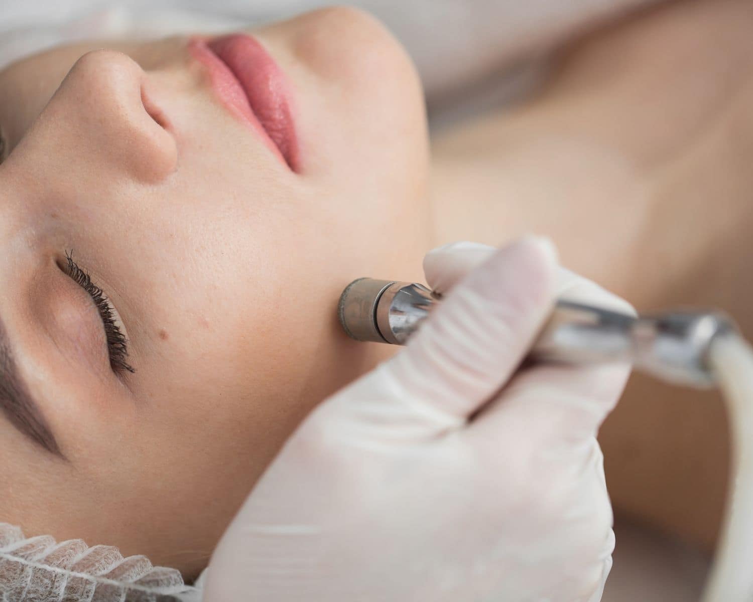 Microdermabrasion Facial - Spa Service at Laughlin Ranch